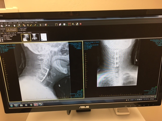 neck